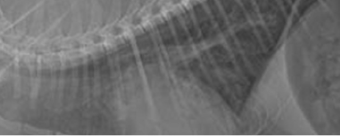 MRI